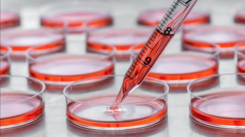 Ex vivo culture of hematopoietic stem and progenitor cells with platelet lysate: Investigating proliferation and erythroid-megakaryocytic lineage effects